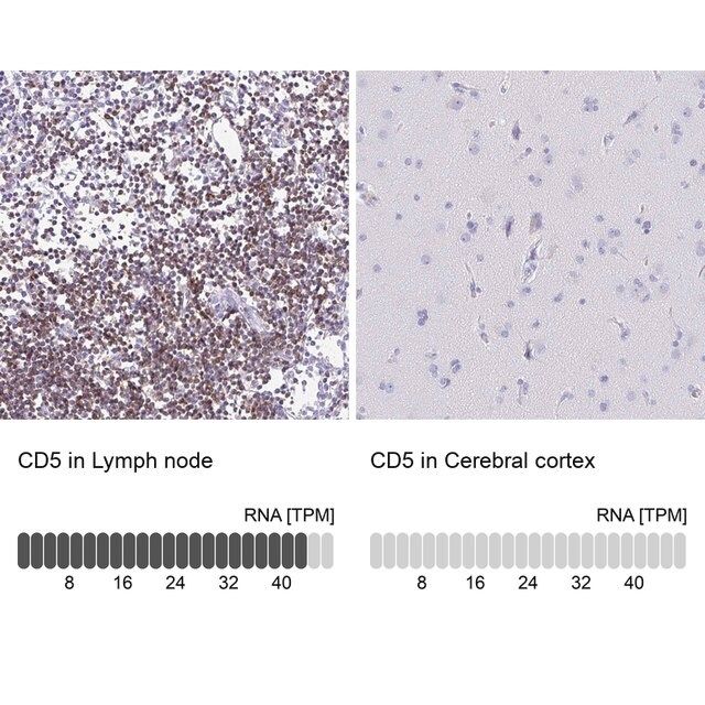 Anti-CD5 antibody produced in rabbit