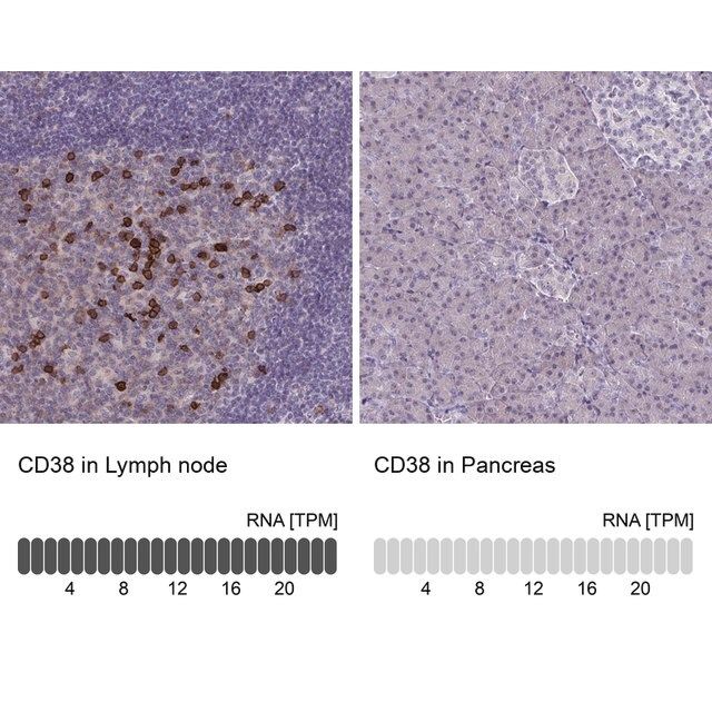 Anti-CD38 antibody produced in rabbit