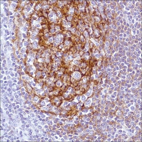 Anti-CD21 antibody, Rabbit monoclonal