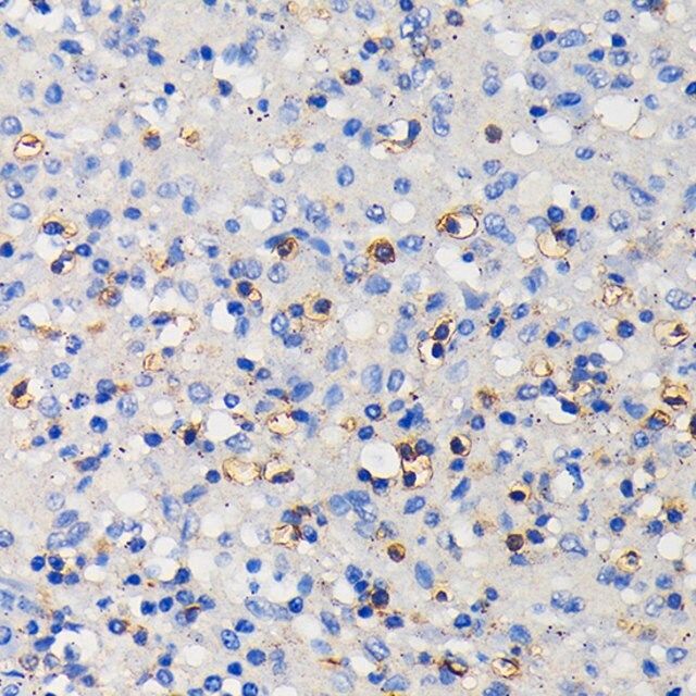 Anti-CD11a/LFA-1A/ITGAL antibody produced in rabbit