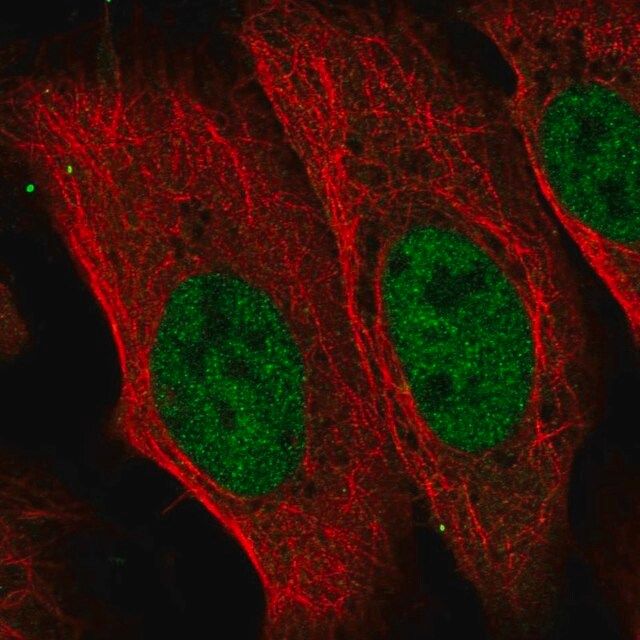 Anti-CDADC1 antibody produced in rabbit