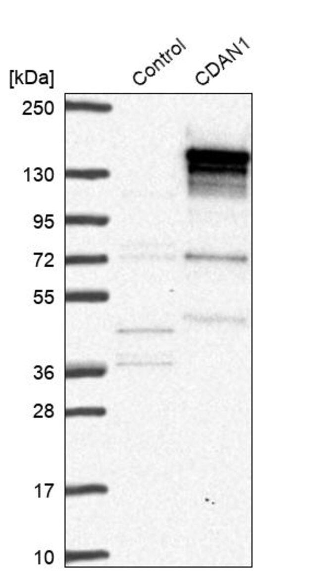 Anti-CDAN1 antibody produced in rabbit