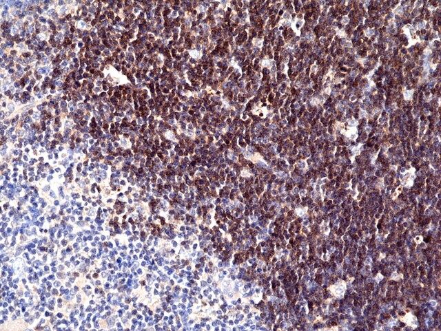 Anti-CD1a Rabbit Monoclonal Antibody