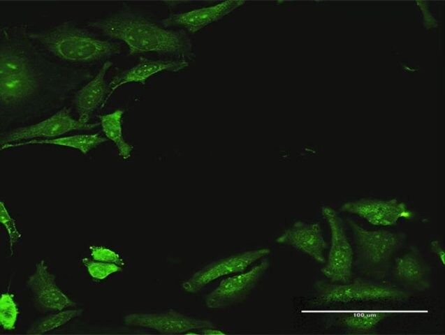 Anti-CDADC1 antibody produced in mouse