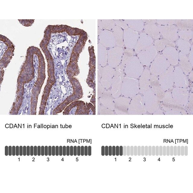 Anti-CDAN1 antibody produced in rabbit