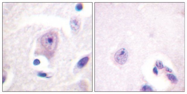 Anti-CDC6 antibody produced in rabbit