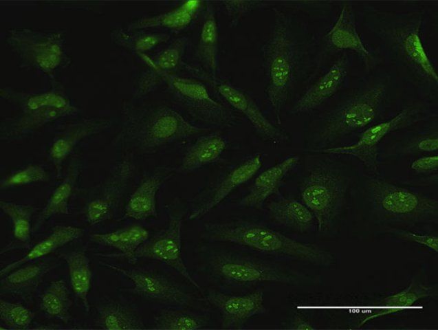 Anti-CDC6 antibody produced in rabbit