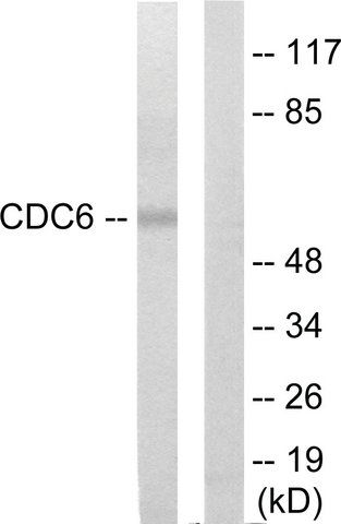 Anti-CDC6 antibody produced in rabbit