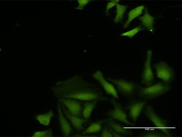 Anti-CDADC1 antibody produced in rabbit