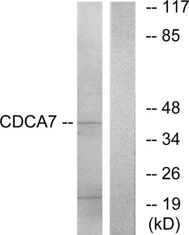 Anti-CDCA7 antibody produced in rabbit