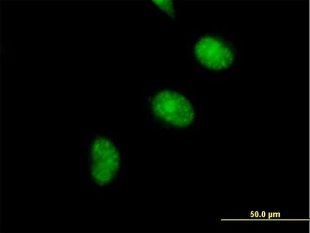 Anti-CDCA5 antibody produced in mouse