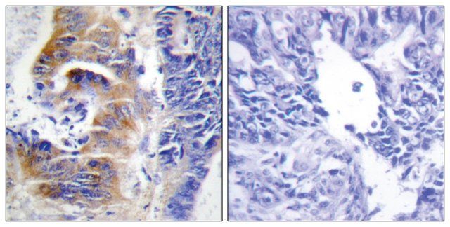 Anti-CDCA3, C-Terminal antibody produced in rabbit