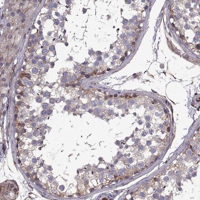 Anti-CDC42BPA antibody produced in rabbit