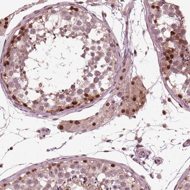 Anti-CDC14A antibody produced in rabbit