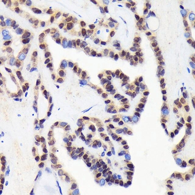 Anti-CDCA5 antibody produced in rabbit