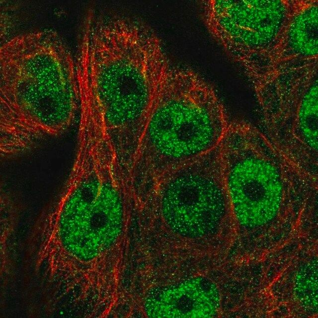 Anti-CDCA4 antibody produced in rabbit