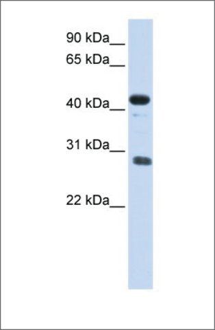 Anti-CDCA5 antibody produced in rabbit