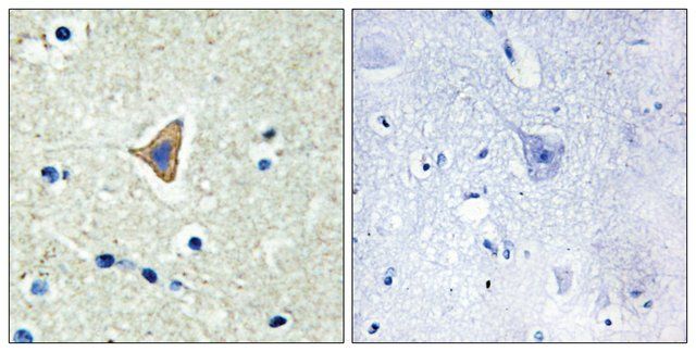 Anti-CDH20 antibody produced in rabbit