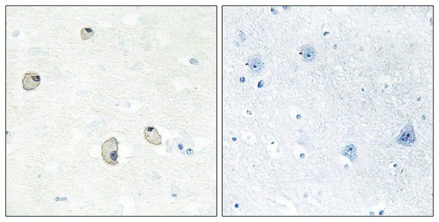 Anti-CDH22 antibody produced in rabbit