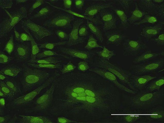 Anti-CDKN2D antibody produced in rabbit