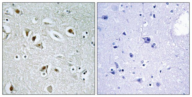 Anti-CDKA2 antibody produced in rabbit