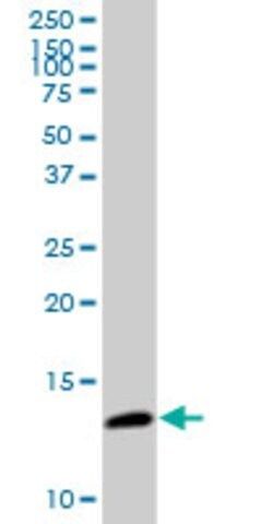 Anti-CDK2AP2 antibody produced in mouse