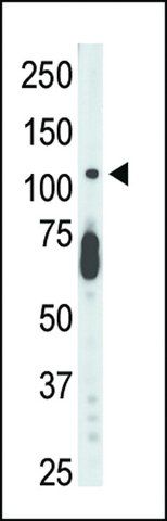 ANTI-CDKL5 (STK9)(C-TERMINAL) antibody produced in rabbit