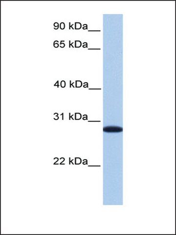 Anti-CDKN3 antibody produced in rabbit