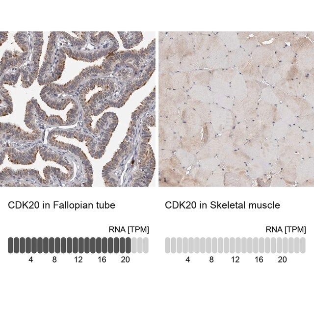 Anti-CDK20 antibody produced in rabbit