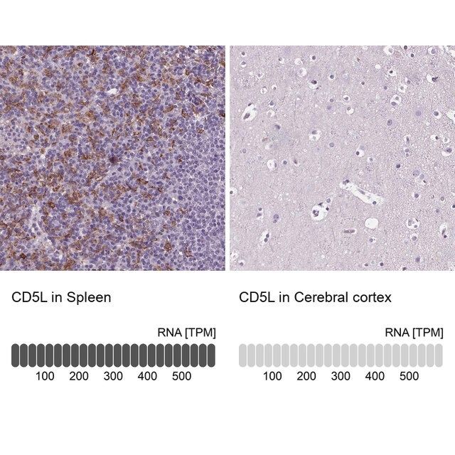 Anti-CD5L antibody produced in rabbit