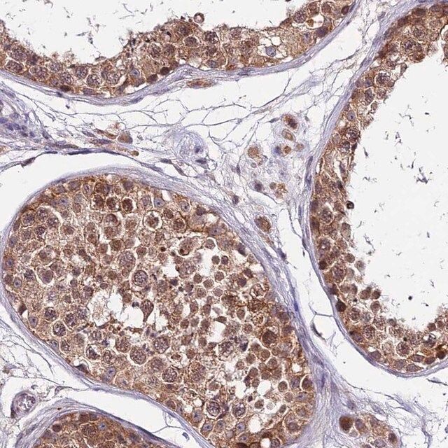 Anti-CDNF antibody produced in rabbit