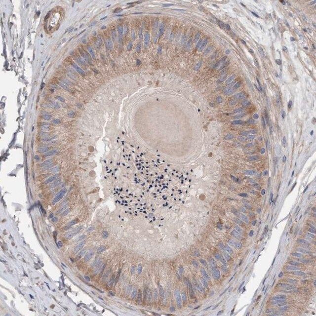 Anti-CDK5RAP3 antibody produced in rabbit