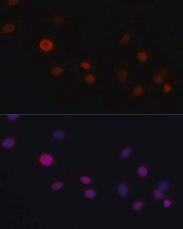 Anti-CDKN1A antibody produced in rabbit