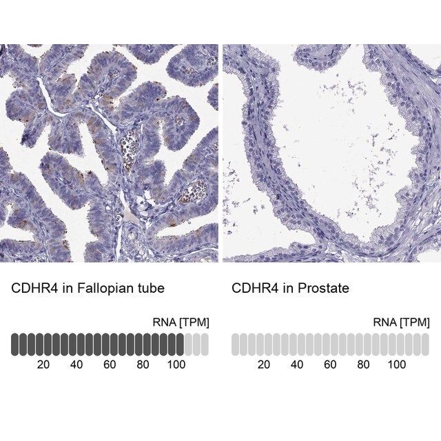 Anti-CDHR4