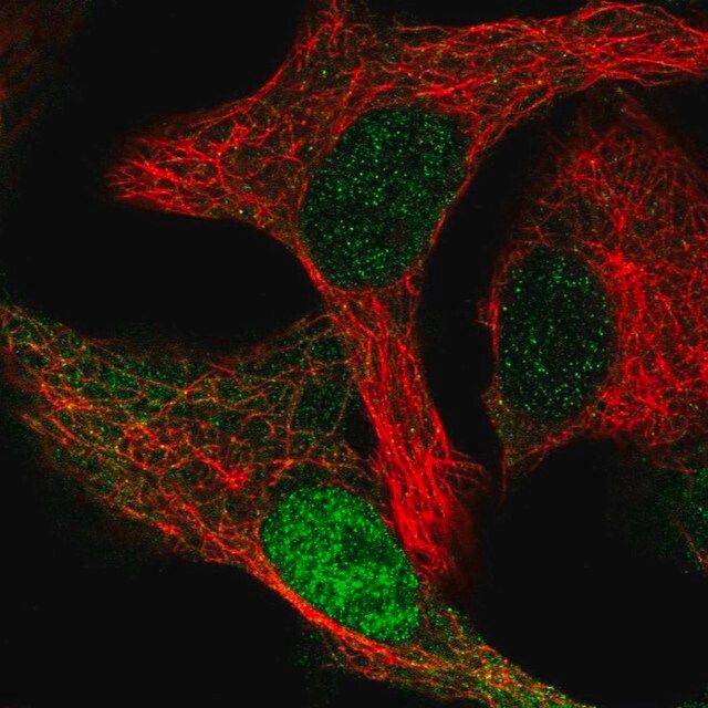 Anti-CDK2AP1 antibody produced in rabbit