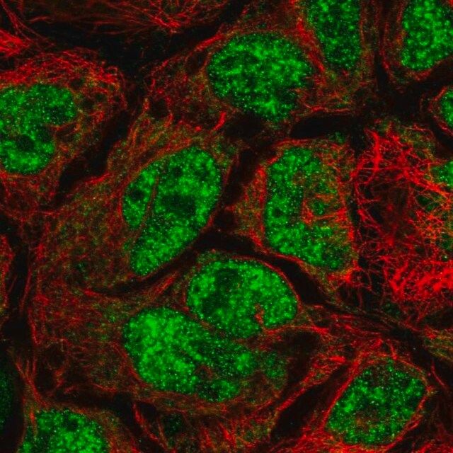 Anti-CDK5RAP1 antibody produced in rabbit