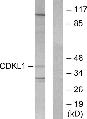 Anti-CDKL1 antibody produced in rabbit