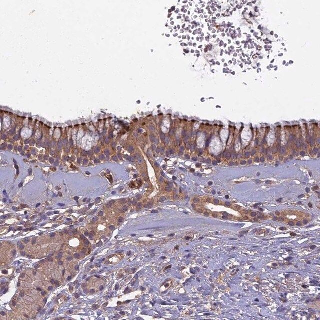 Anti-CCDC167 antibody produced in rabbit