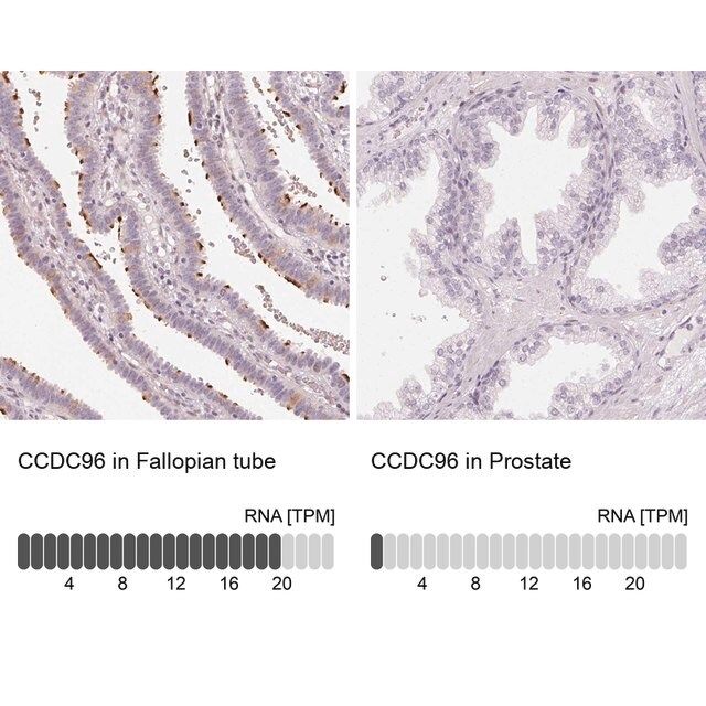 Anti-CCDC96 antibody produced in rabbit