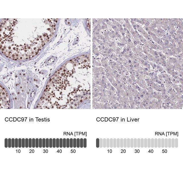 Anti-CCDC97 antibody produced in rabbit