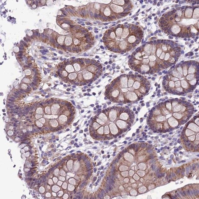 Anti-CCDC191 antibody produced in rabbit