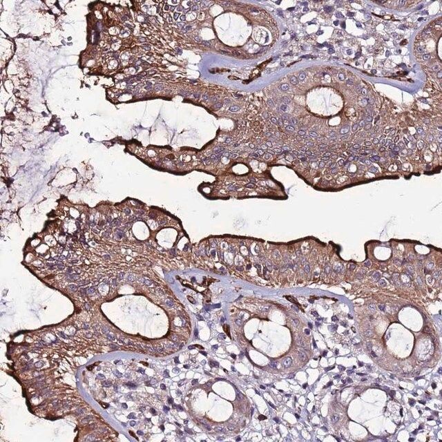 Anti-CCDC71 antibody produced in rabbit