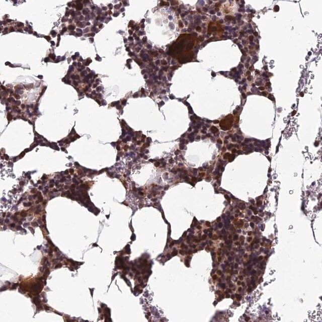 Anti-CCDC183 antibody produced in rabbit