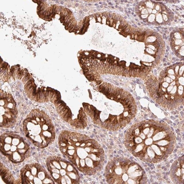 Anti-CCDC130 antibody produced in rabbit