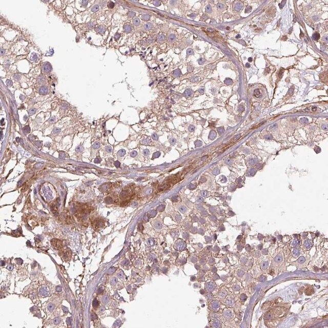 Anti-CCDC93 antibody produced in rabbit