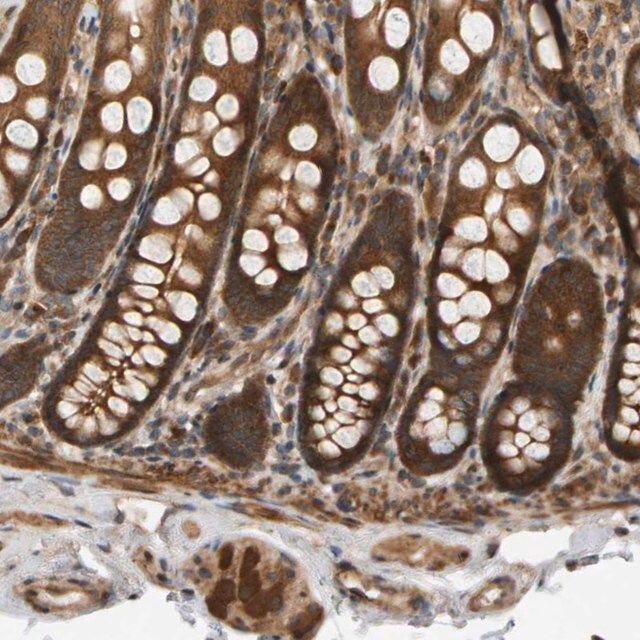 Anti-BAHCC1 antibody produced in rabbit