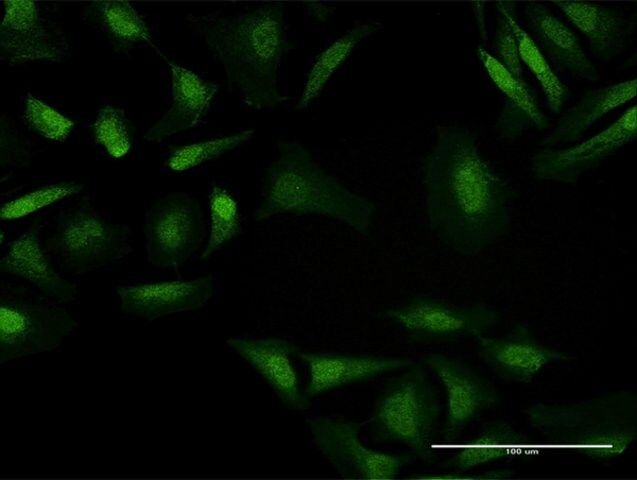 Anti-BAHD1 antibody produced in mouse