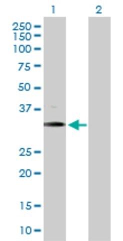 Anti-BARHL1 antibody produced in rabbit