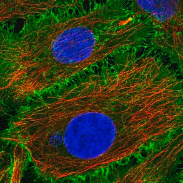 Anti-BASP1 antibody produced in rabbit