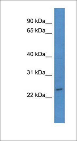 Anti-BASP1 antibody produced in rabbit